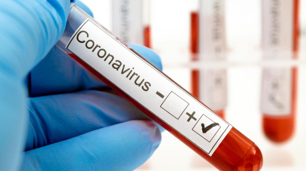 Κορονοϊός: 39 θάνατοι από Covid-19, 25 ασθενείς διασωληνωμένοι | Business  Daily