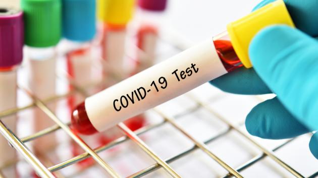 Τεστ CΔOοVκIιDμ-α1σ9τ ισκεό ςδ οσκωιλμήανσατςι κCόO VσIωDλ-ή1ν9α