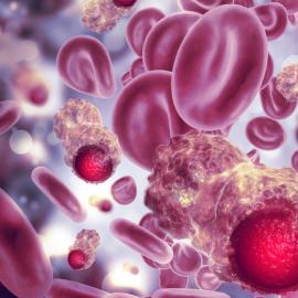 Καρκινικά κύτταρα αίματος