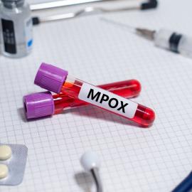 Δοκιμαστικός σωλήνας MPOX