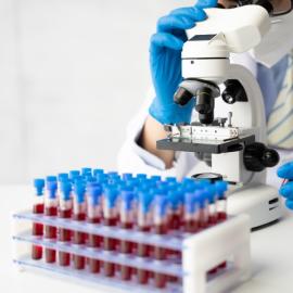 Εξέταση αίματος εργαστήριο